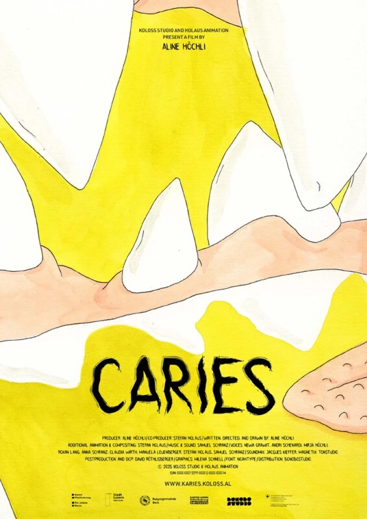 Caries